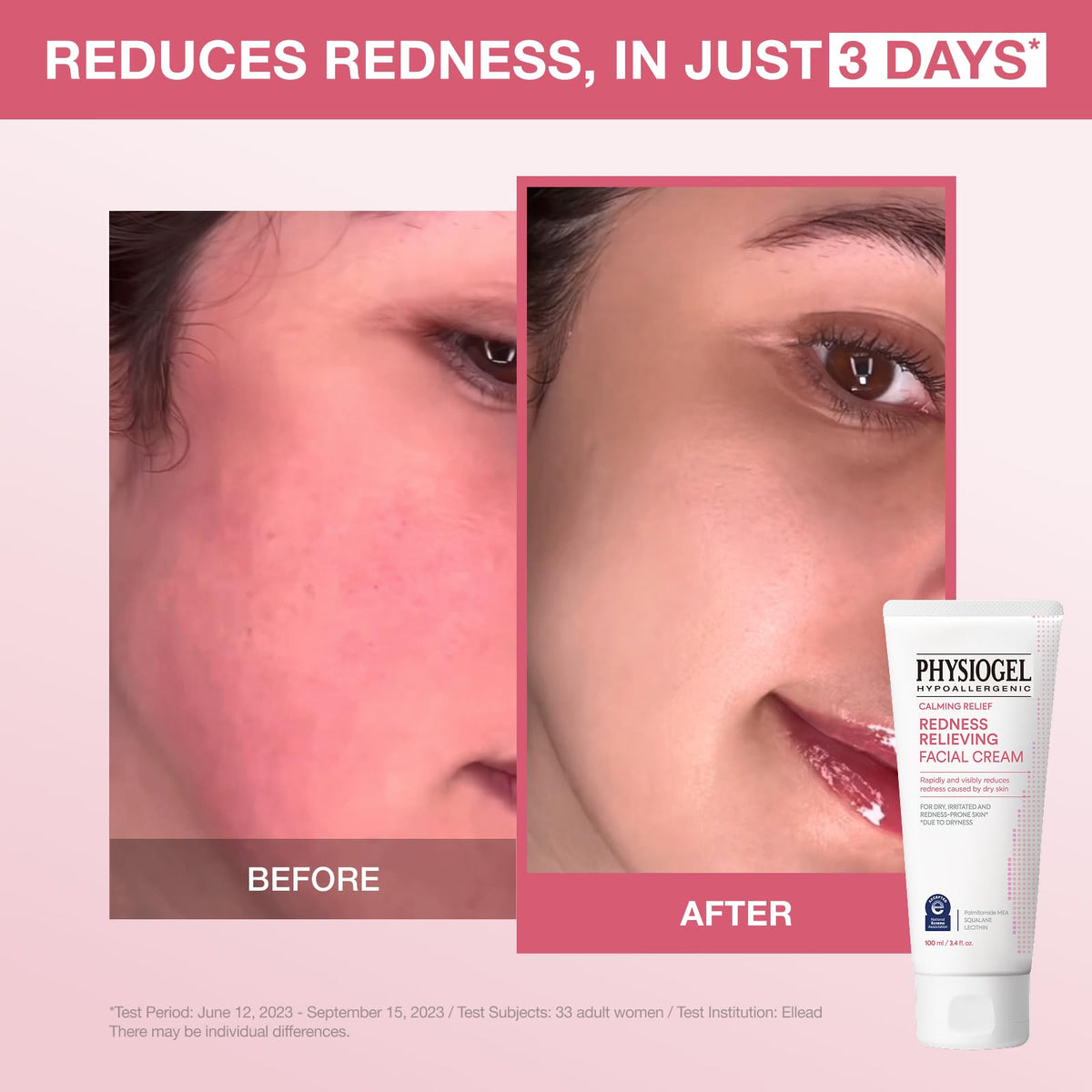 PHYSIOGEL cream texture close-up displaying smooth consistency for fast absorption and soothing hydration