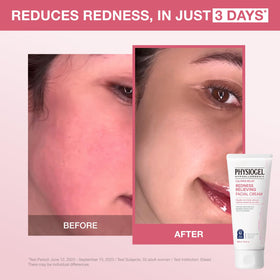 PHYSIOGEL cream texture close-up displaying smooth consistency for fast absorption and soothing hydration