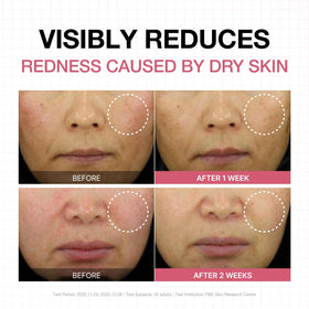PHYSIOGEL applied to face in morning routine, soothing redness and calming skin