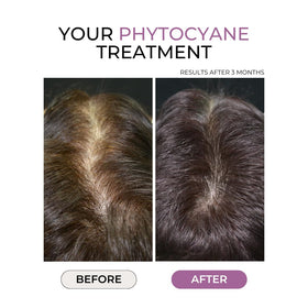 PHYTO closeup of capsule texture highlighting vegan, clean-ingredient benefit