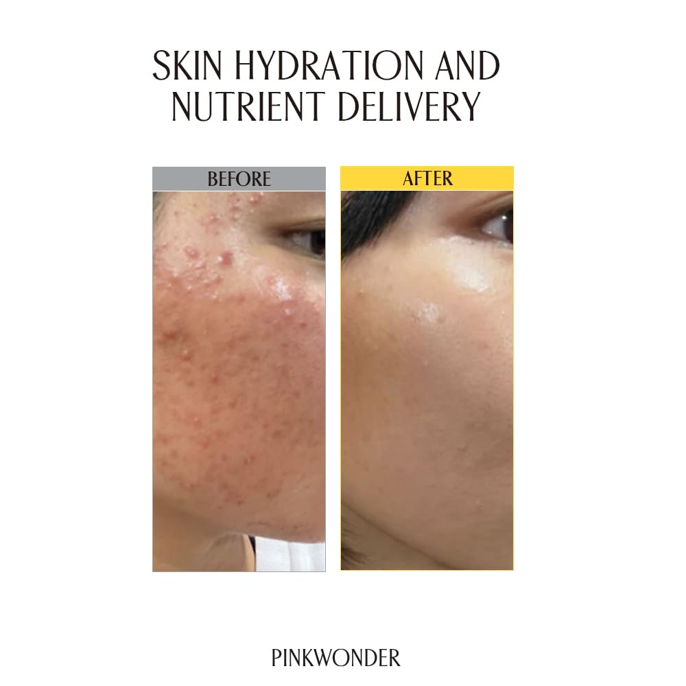 PINKWONDER toner in hand demonstrating quick absorption and easy application