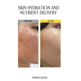 PINKWONDER toner in hand demonstrating quick absorption and easy application