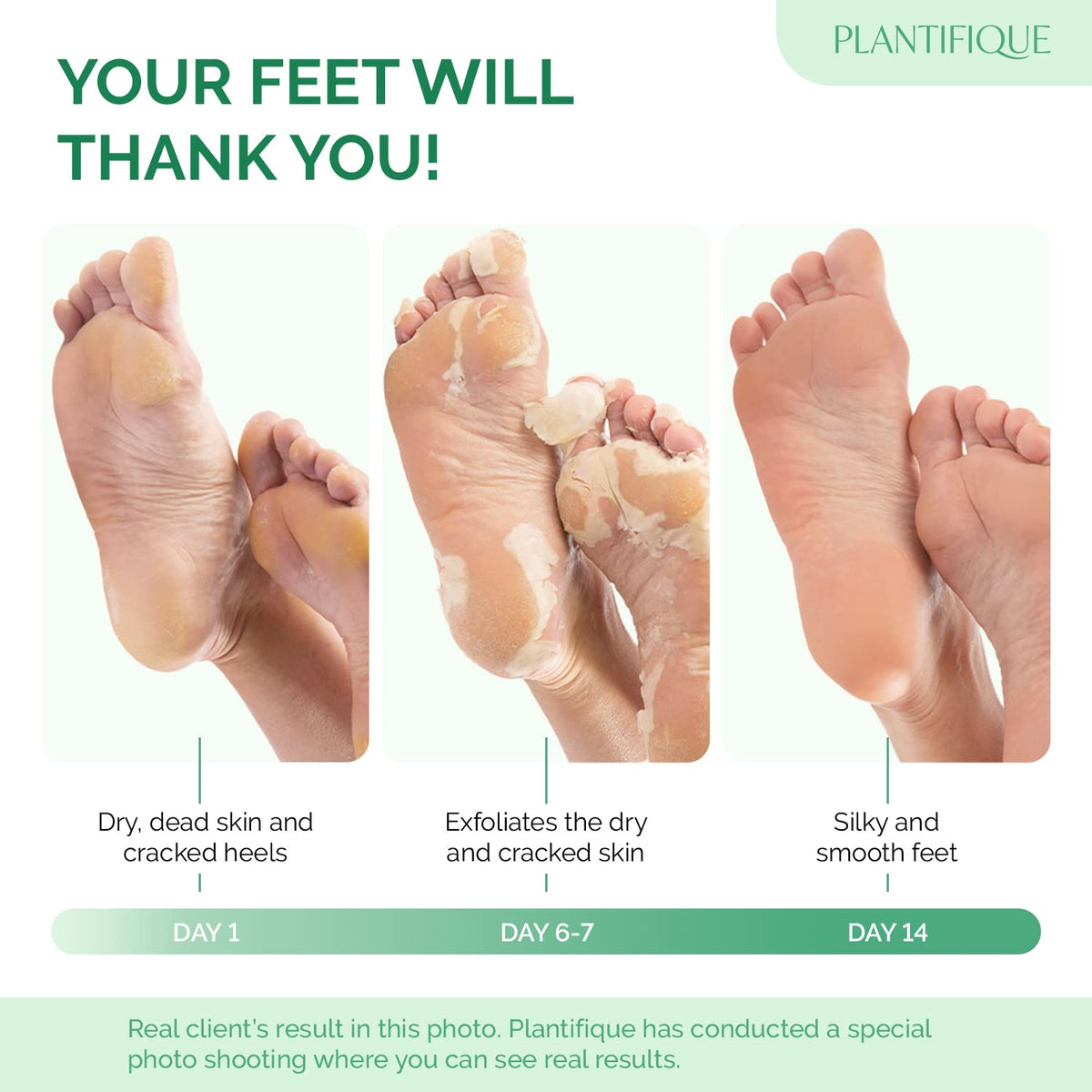 PLANTIFIQUE close-up of booties with peeling solution demonstrating texture