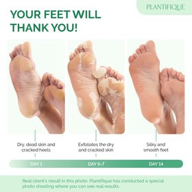 PLANTIFIQUE close-up of booties with peeling solution demonstrating texture