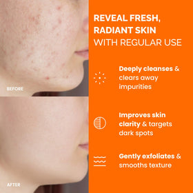 PLANTIFIQUE close-up textured pad for gentle exfoliation benefit