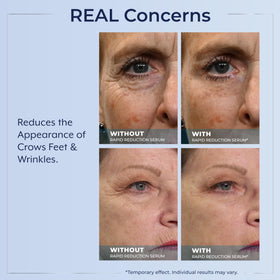 Plexaderm application demonstration on under-eye showing easy, even coverage benefit
