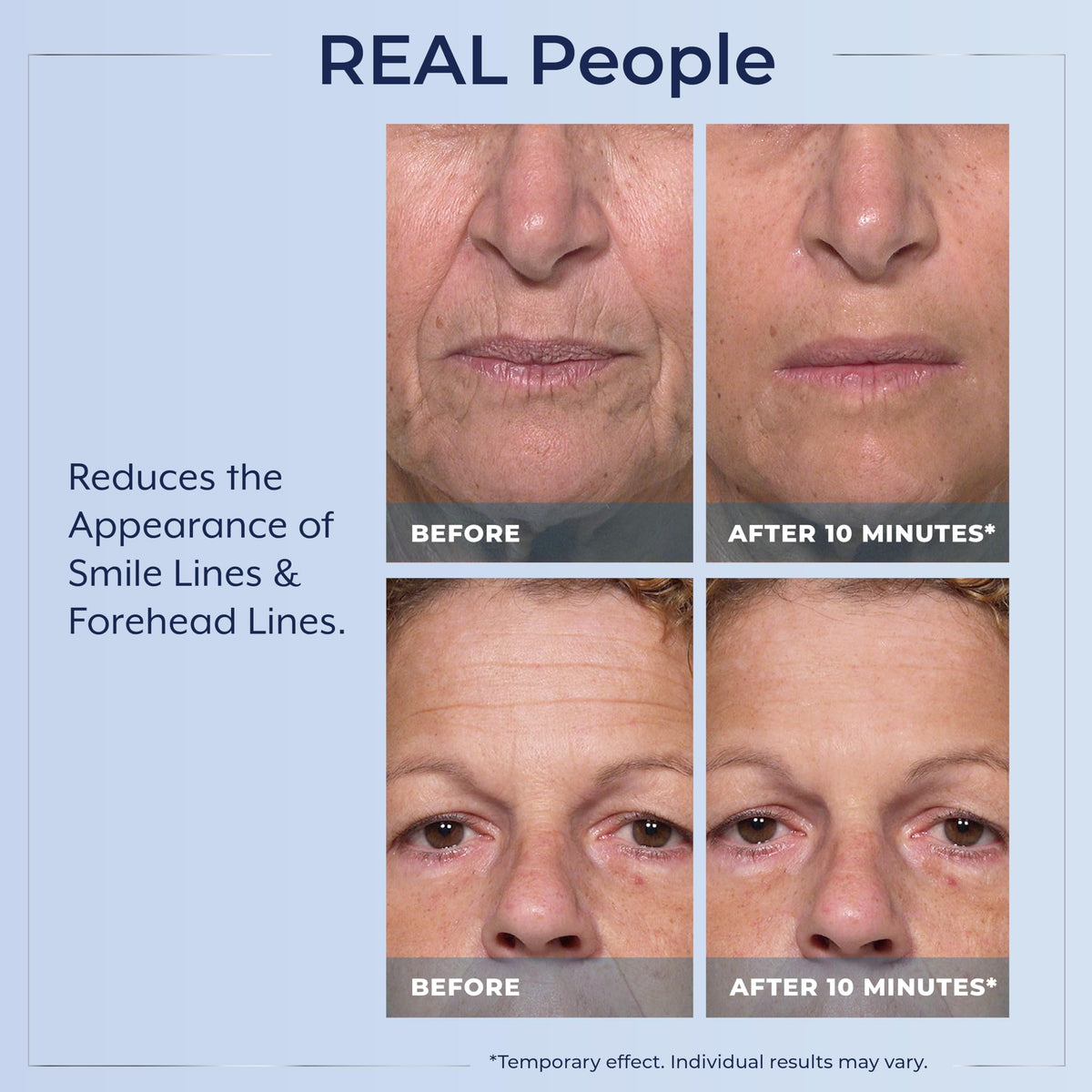 Applying Plexaderm under eye demonstrating visible tightening and reduced puffiness