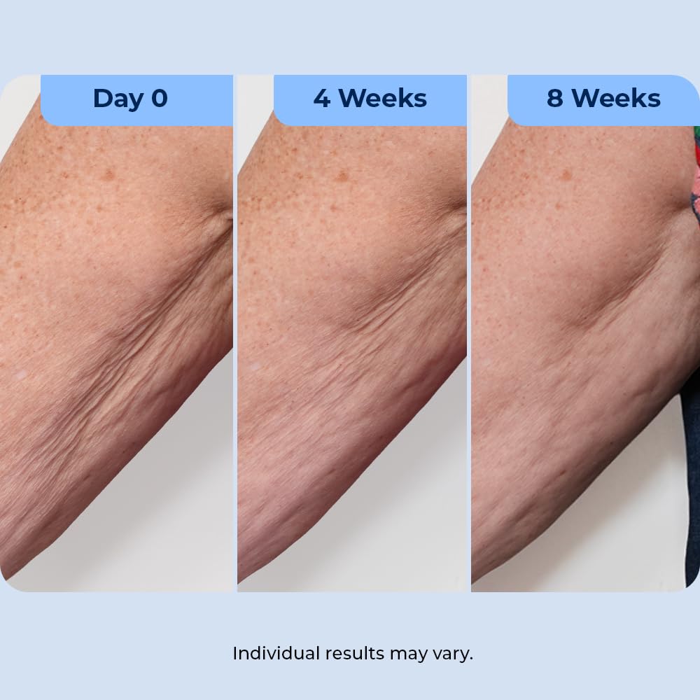 Plexaderm ingredient layout featuring retinol and bakuchiol, dual-action anti-aging benefit