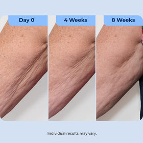 Plexaderm ingredient layout featuring retinol and bakuchiol, dual-action anti-aging benefit