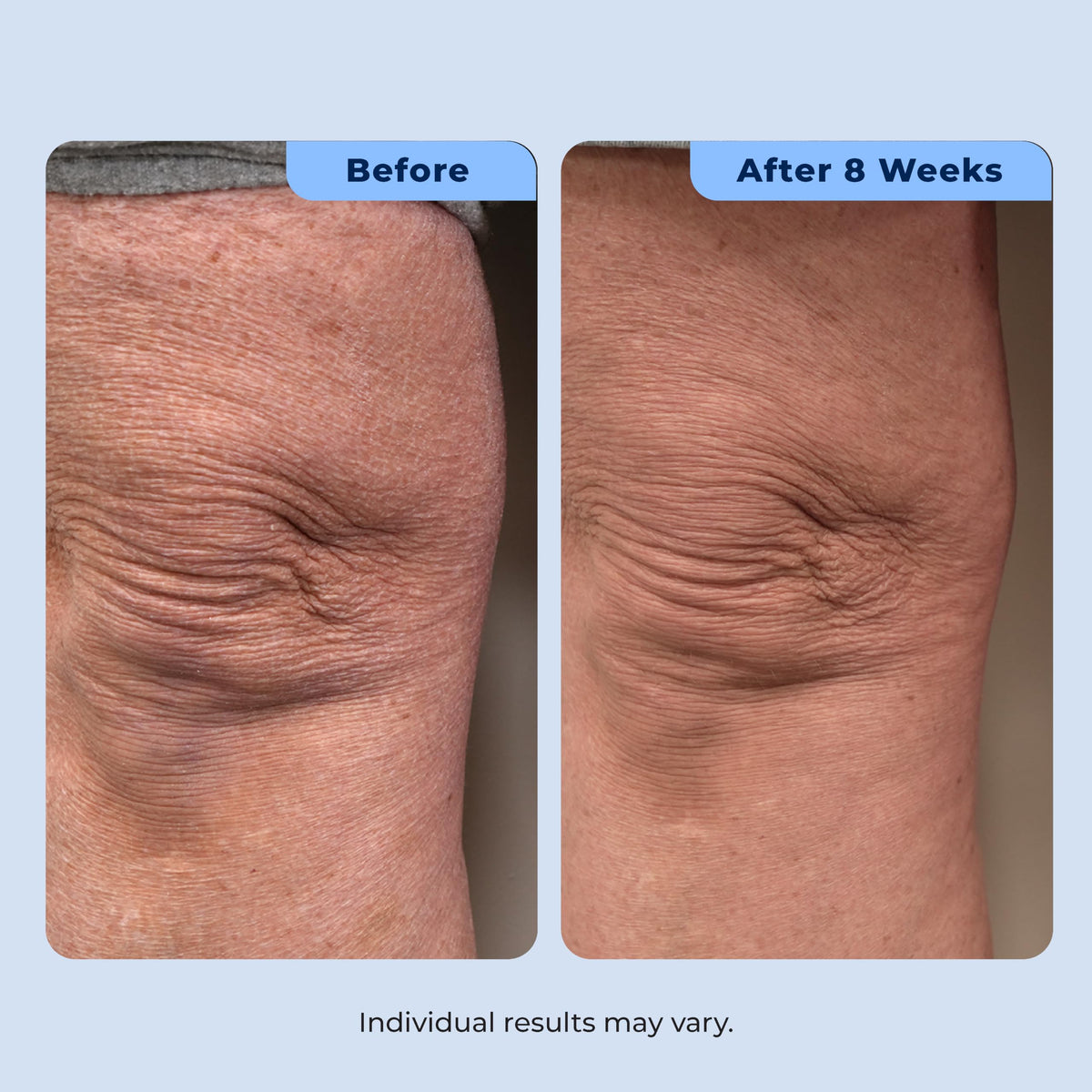 Plexaderm label close-up with ingredient list visible, transparency and safety benefit