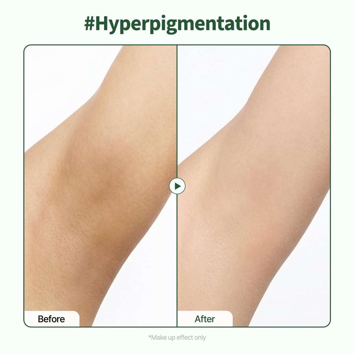 PONGDANG before and after arm comparison showing evened skin tone