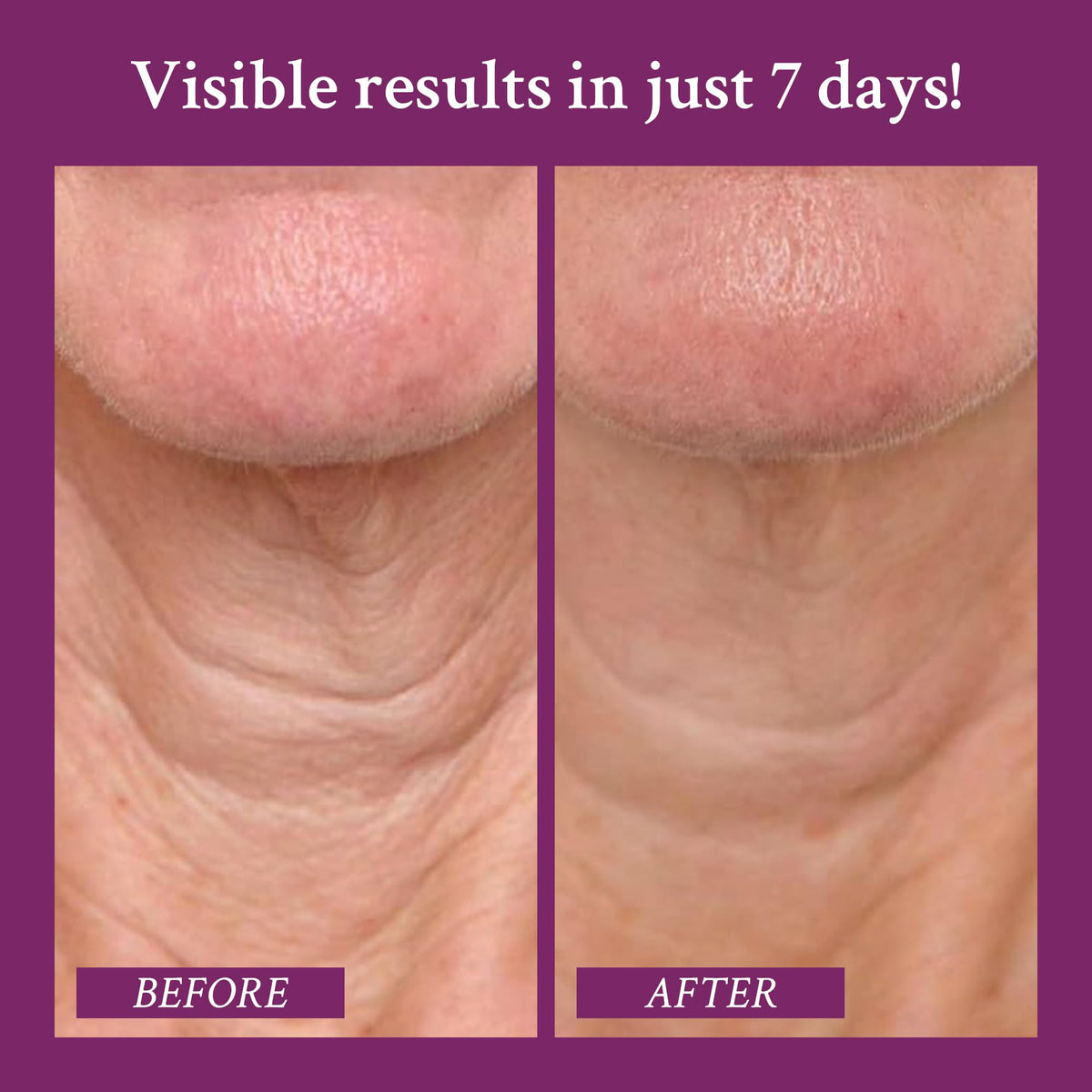 PRAI ingredient focus on Sepilift technology demonstrating targeted lifting benefit