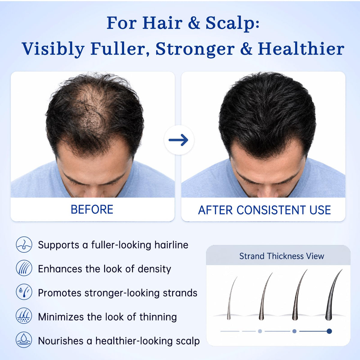Applying Prazipuantal hair tonic to scalp, illustrating conditioning and fuller-look benefit