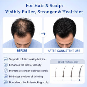 Applying Prazipuantal hair tonic to scalp, illustrating conditioning and fuller-look benefit