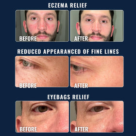 PrettyBoy applied to face and neck after cleansing for quick absorption