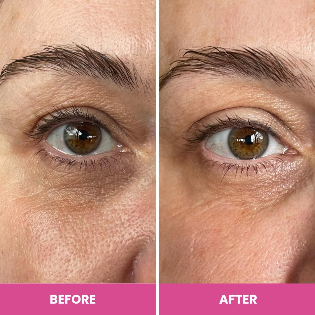 PRIME PROMETICS PrimeEyes size comparison in hand to show compact travel-friendly benefit