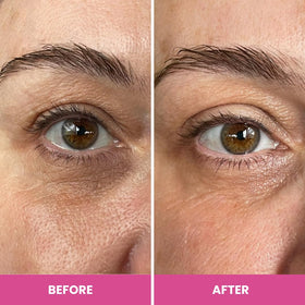 PRIME PROMETICS PrimeEyes size comparison in hand to show compact travel-friendly benefit