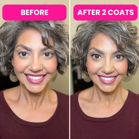 Prime Prometics on mature woman illustrating natural-looking volume benefit