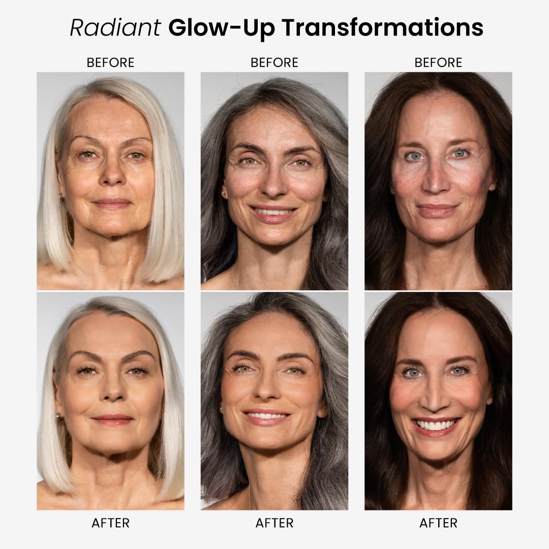 Prime Prometics skin before and after view showing evened tone and natural coverage benefit