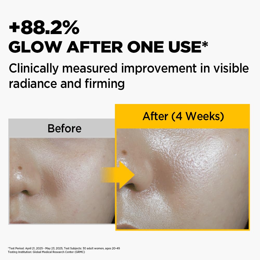 Primera mask being applied on face showing comfortable overnight fit