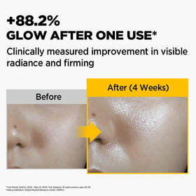 Primera mask being applied on face showing comfortable overnight fit
