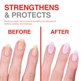 Probelle before and after comparison revealing reduced peeling and better texture