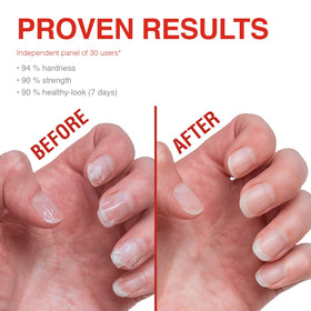 Probelle before and after nails showing reduced splits and improved texture