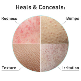PROcure Rosacare licorice root extract visual emphasizing soothing brightening benefits