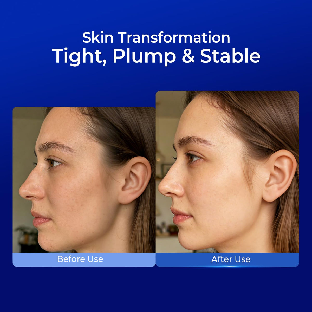 PROF.LING applied after microneedling demonstrating soothing post-procedure care