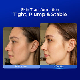 PROF.LING applied after microneedling demonstrating soothing post-procedure care