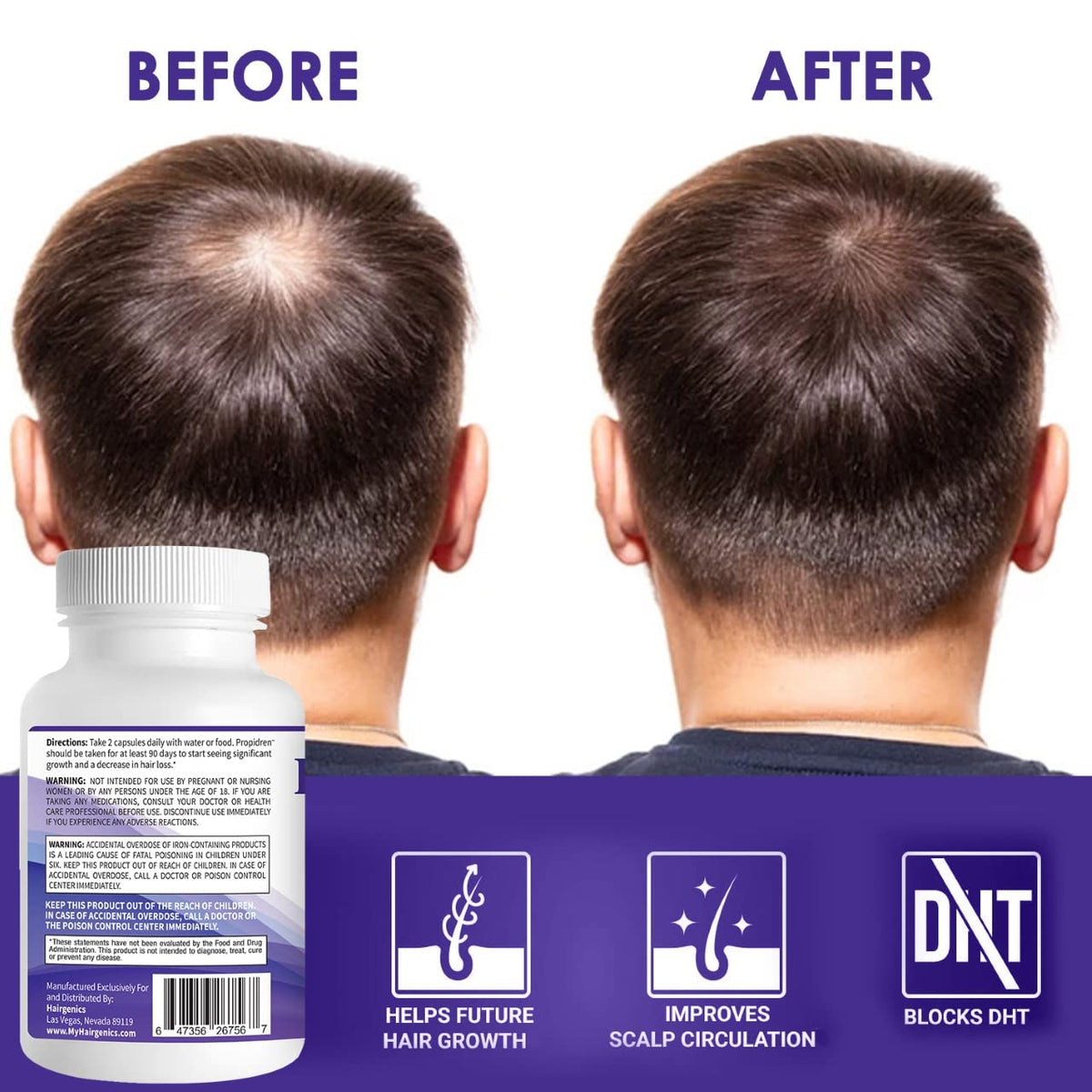 Pronexa Propidren conceptual before and after indicating fuller-looking hair