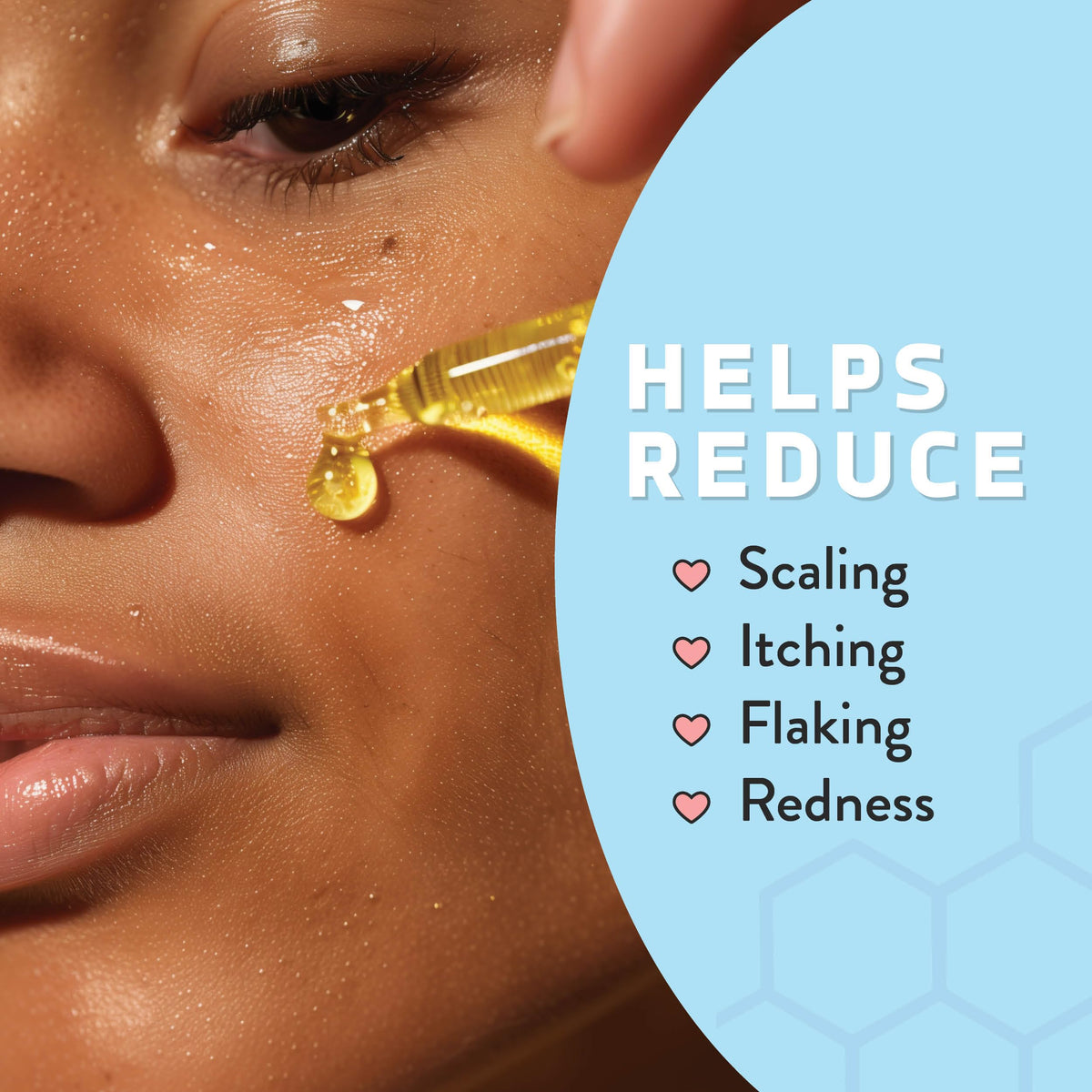 PSORIASIS HONEY texture closeup of lightweight oil on skin showing quick absorption benefit