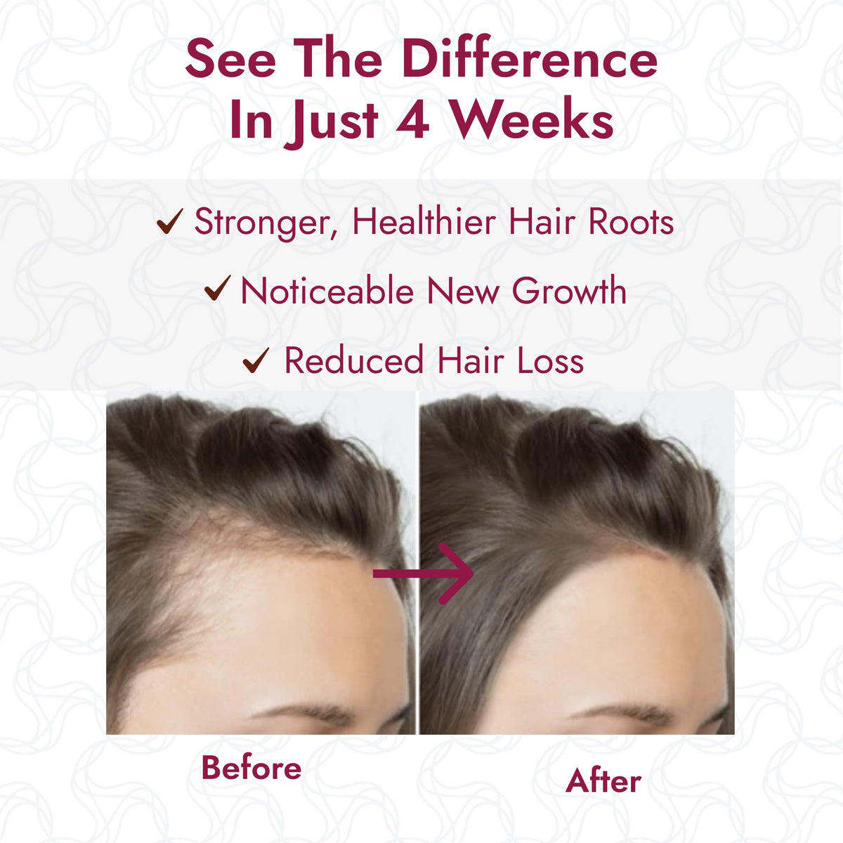 Puggaree applying serum to thinning scalp demonstrating targeted use