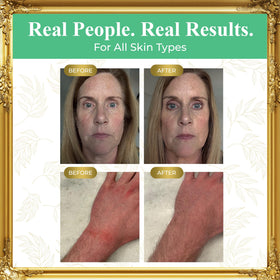 Pure Truth balm being applied to hand demonstrating quick absorption and hydration benefit