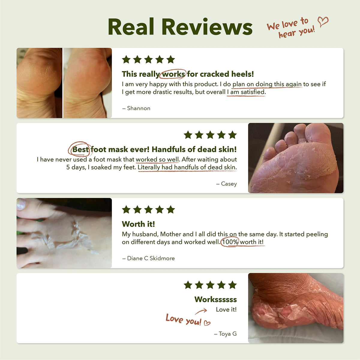 Purederm beach-ready feet lifestyle showing confidence and smoother skin
