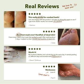 Purederm beach-ready feet lifestyle showing confidence and smoother skin