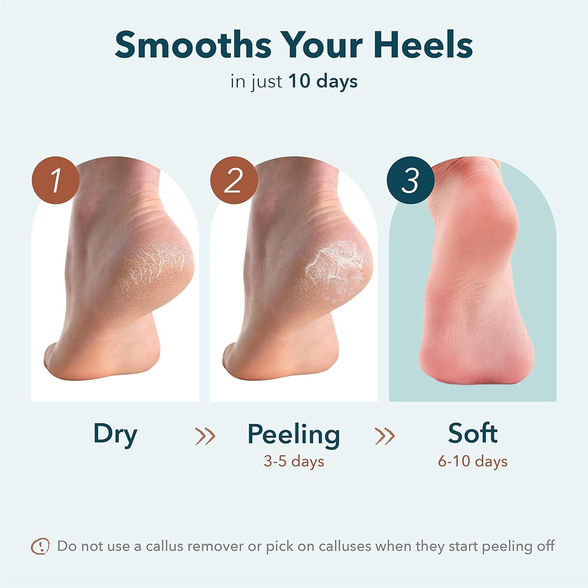 Purederm heel mask applied on foot demonstrating easy at-home use