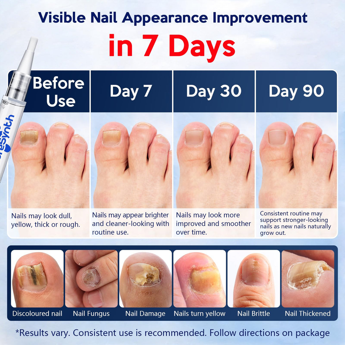 PureSynth precision tip close-up showing targeted application for hard-to-reach nail edges