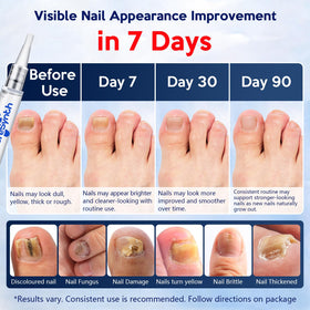 PureSynth precision tip close-up showing targeted application for hard-to-reach nail edges