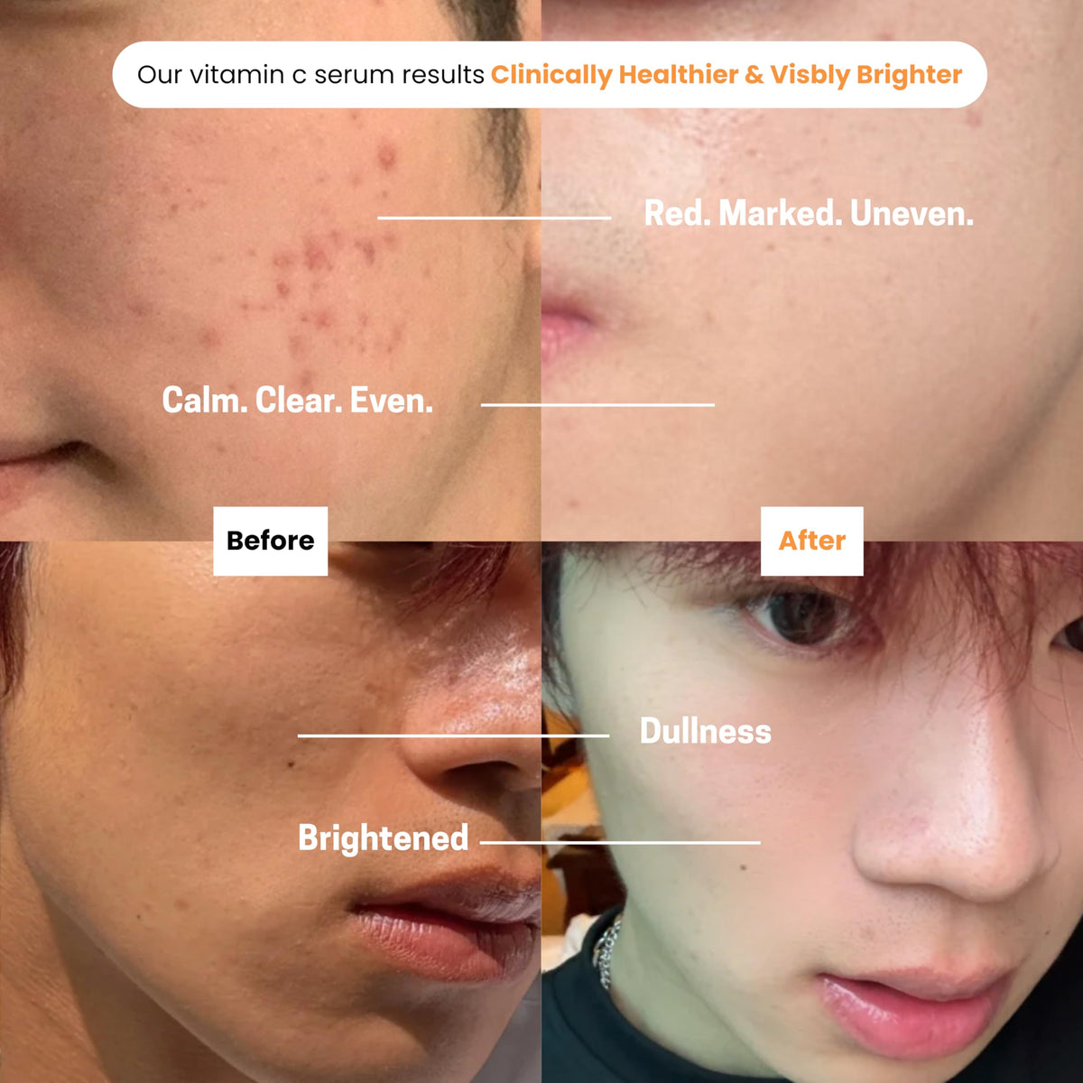 Purify serum texture on skin showing lightweight absorption and non-greasy finish