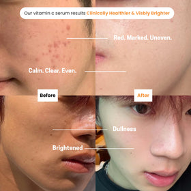 Purify serum texture on skin showing lightweight absorption and non-greasy finish