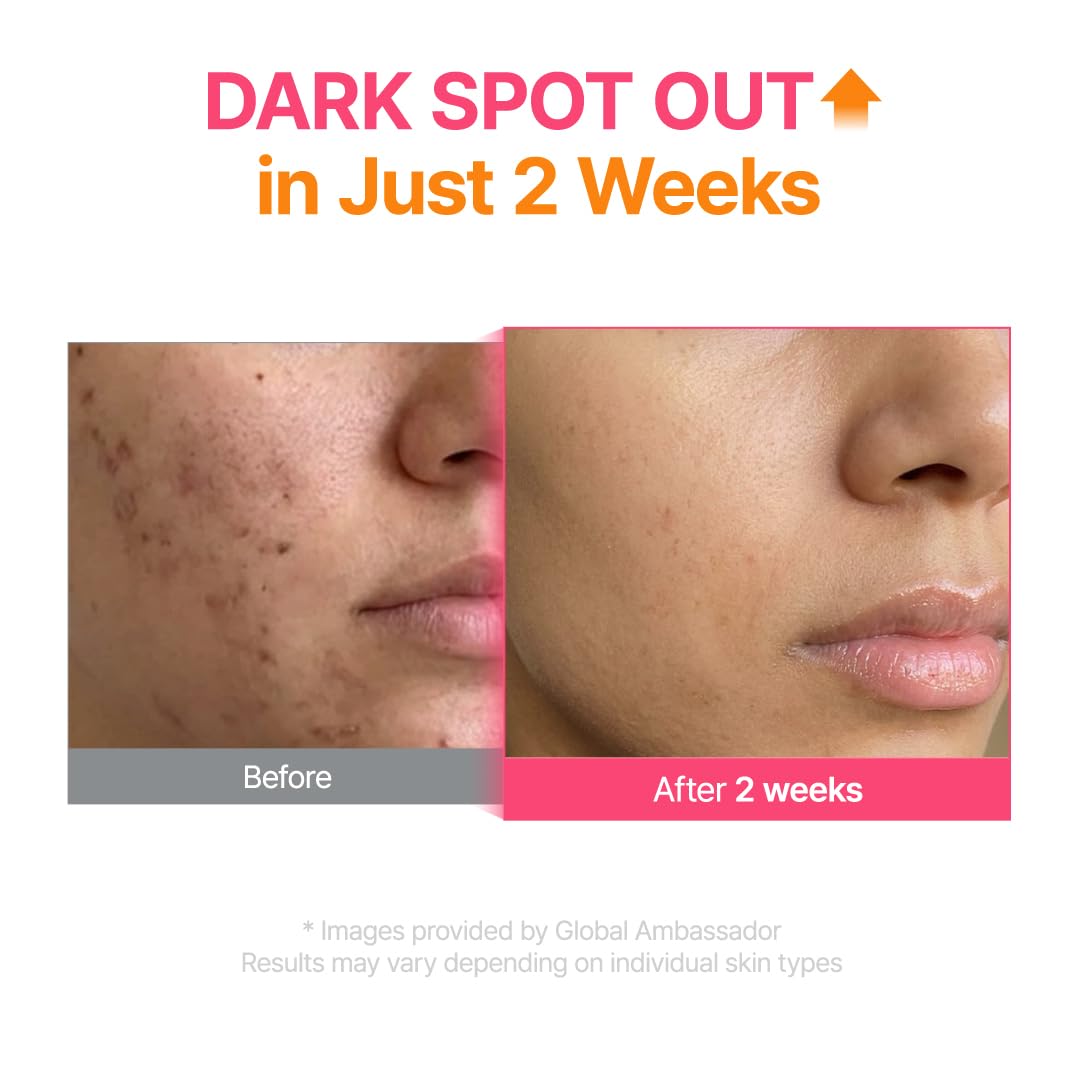 PURITO serum on hand demonstrating smooth texture and even application