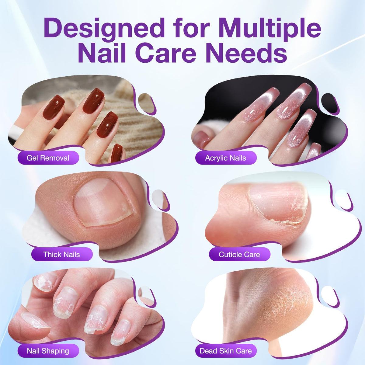 PYRYSA device in use during a manicure demonstrating precision