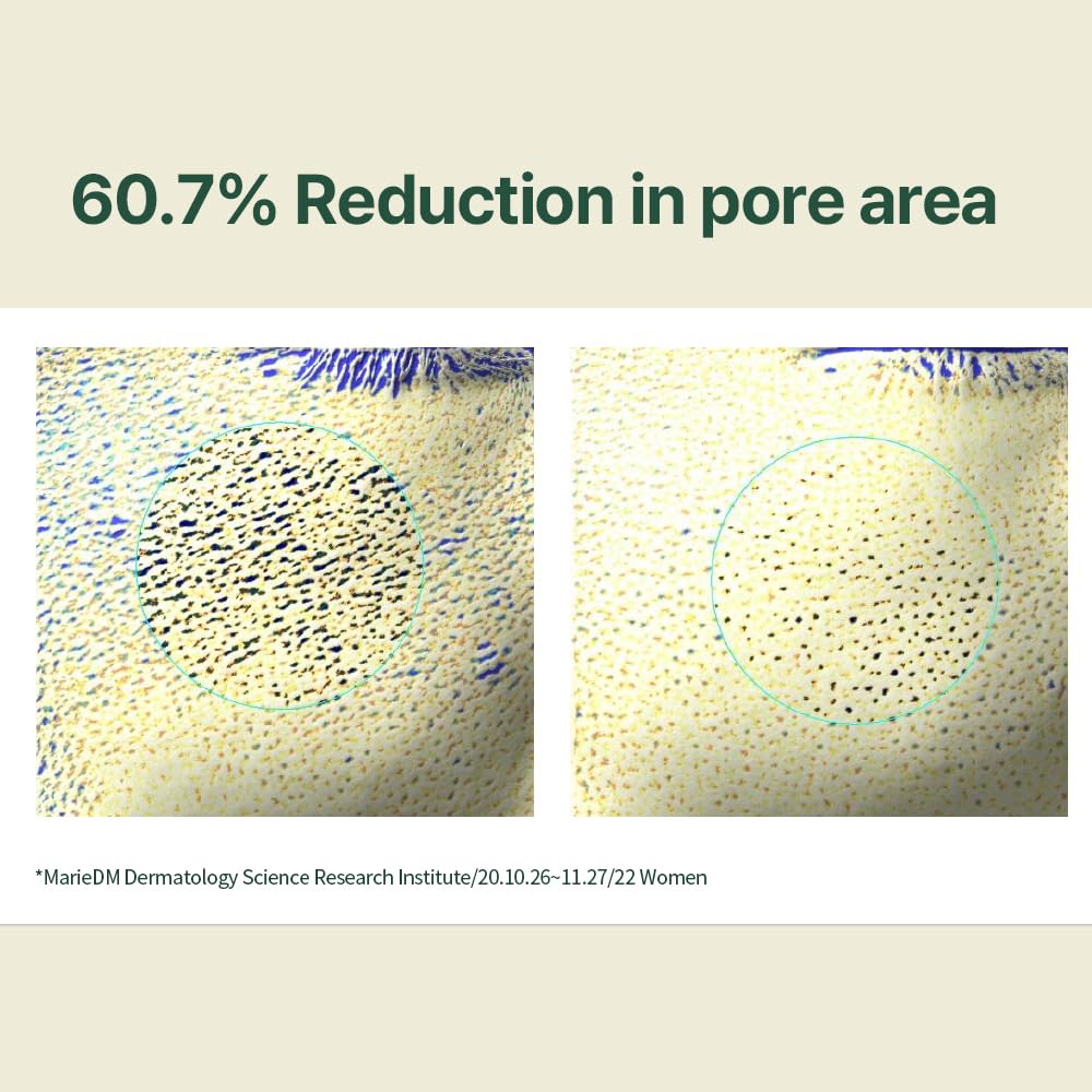 Pyunkang Yul centella asiatica extract image highlighting soothing ingredient and calming benefit