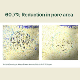 Pyunkang Yul centella asiatica extract image highlighting soothing ingredient and calming benefit