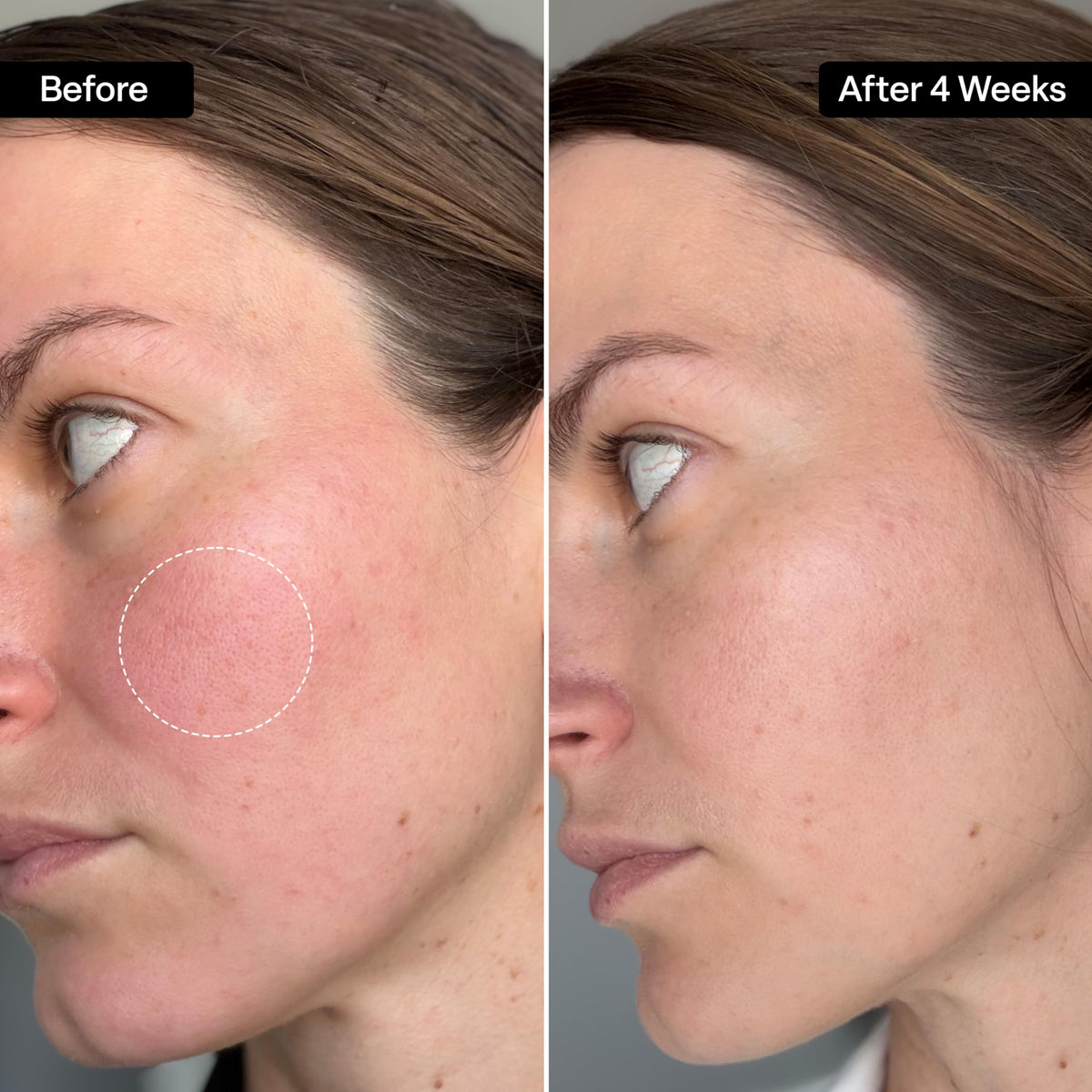 QRxLabs squalane oil texture on skin, showing fast absorption and non-greasy finish