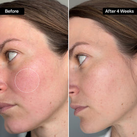 QRxLabs squalane oil texture on skin, showing fast absorption and non-greasy finish