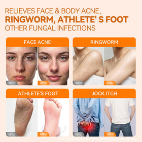 QualiLife ingredient label showing 1% tolnaftate and botanical blend