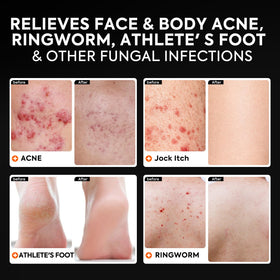 QualiLife mesh soap bag included for better lathering and gentle exfoliation