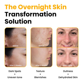 QUIA mask on model during night routine demonstrating comfortable wear